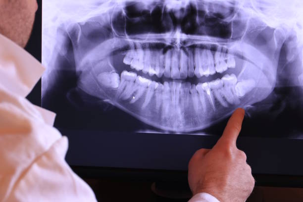 Best Emergency Wisdom Teeth Removal in Surgoinsville, TN