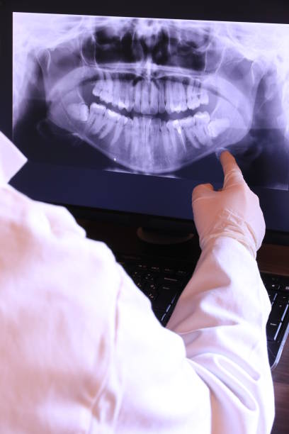 Best Emergency Tooth Extraction in Surgoinsville, TN